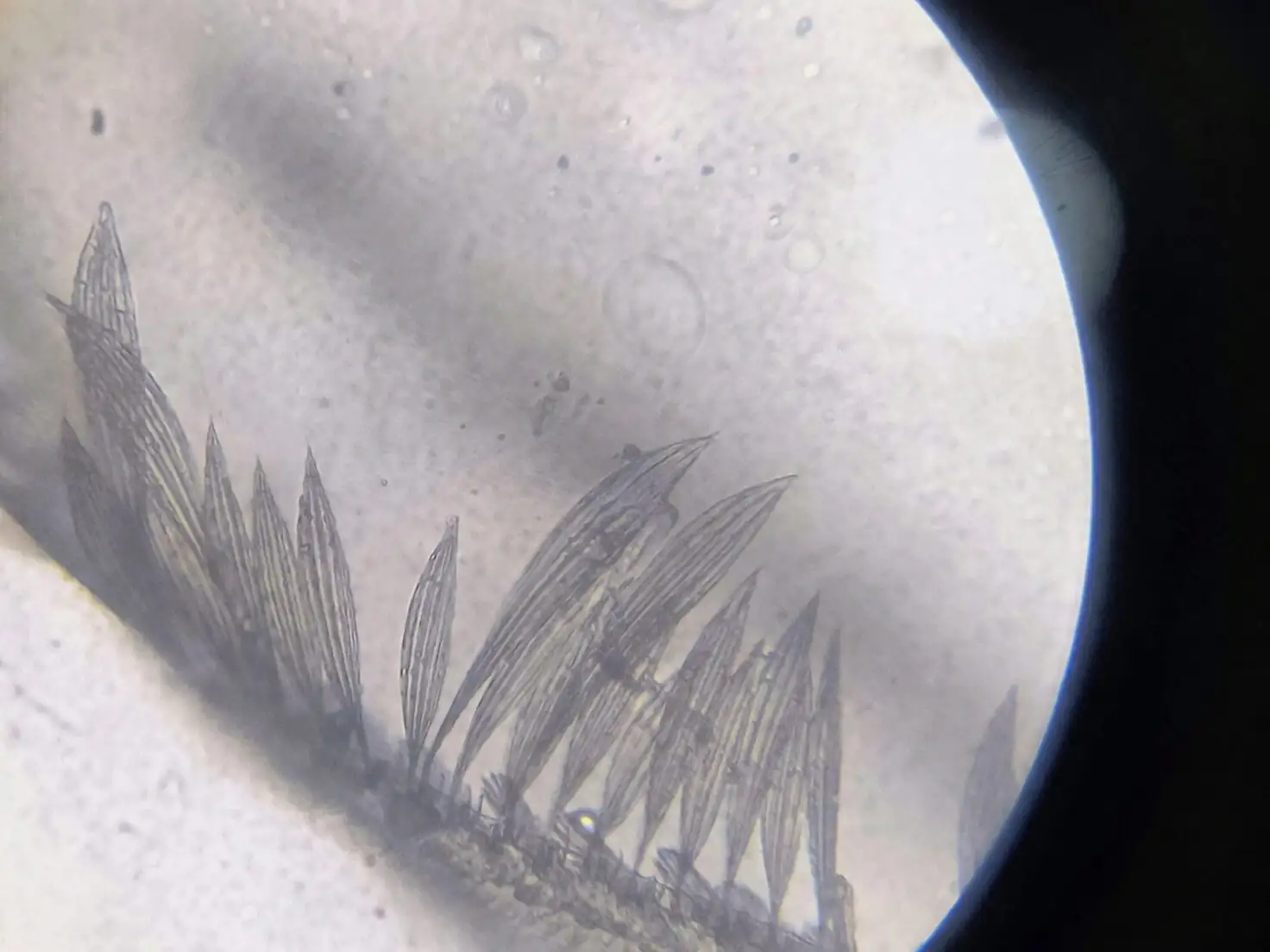 calcium oxalate raphides microscope