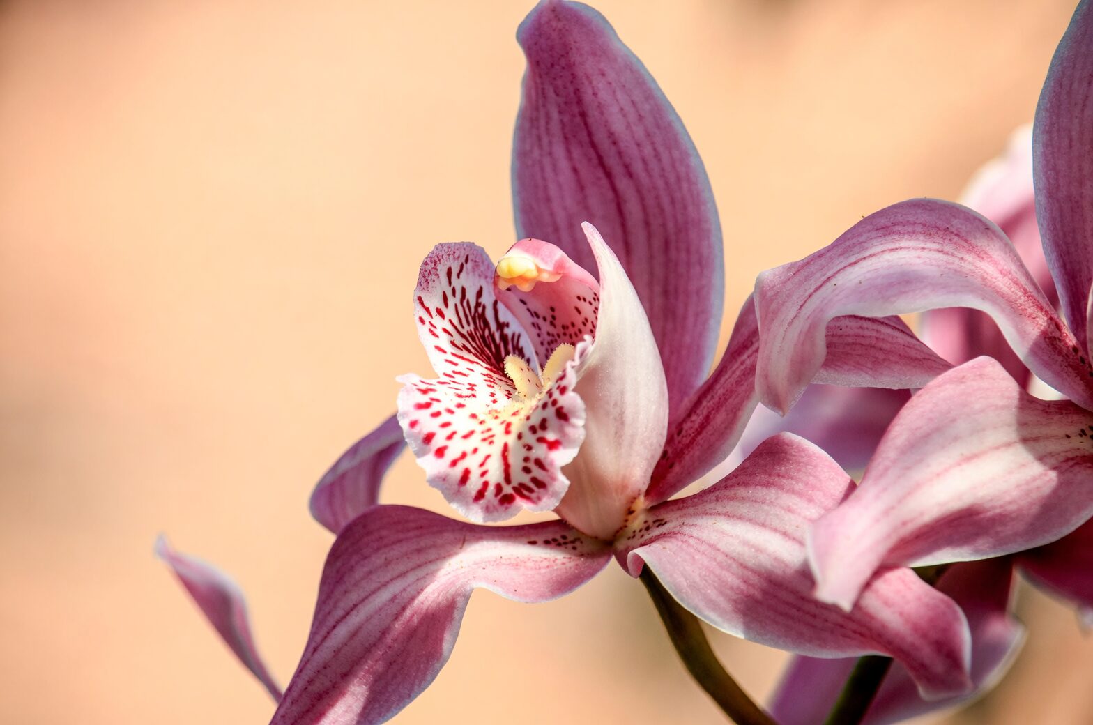 Divide and Thrive: A No-Fear Cymbidium Propagation Masterclass