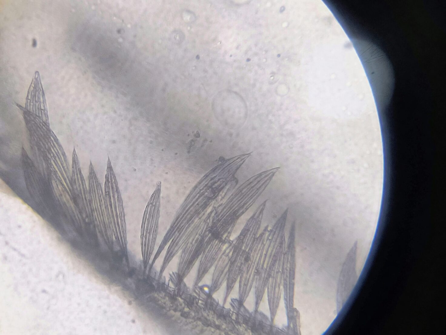 calcium oxalate raphides microscope